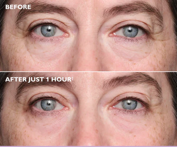 Verloura Glow Collagen Eye Patches