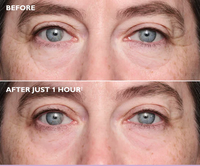 Verloura Glow Collagen Eye Patches